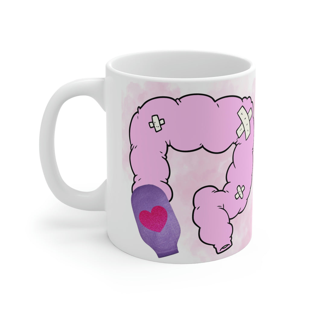 OSTOMY LIFE SHIT-UATION White Ceramic Mug (purple)